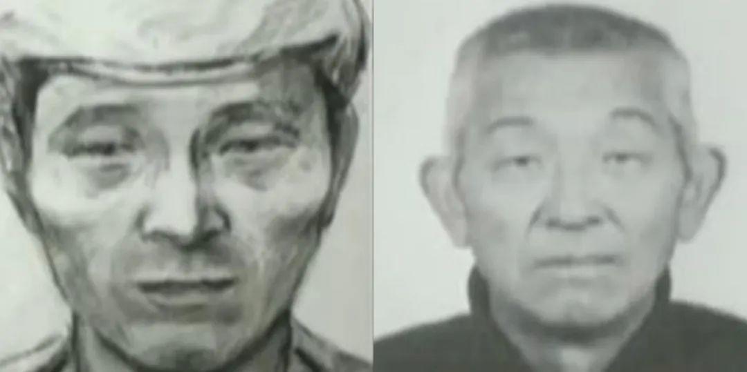 20岁女人整容失败案例,女人整容失败电视剧