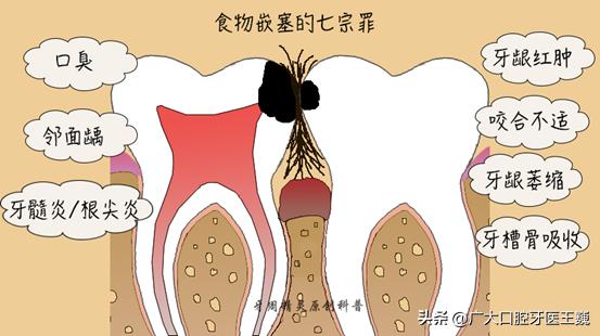 牙疼想知道自己是哪种牙疼,牙疼也算病一招解决绝对有效