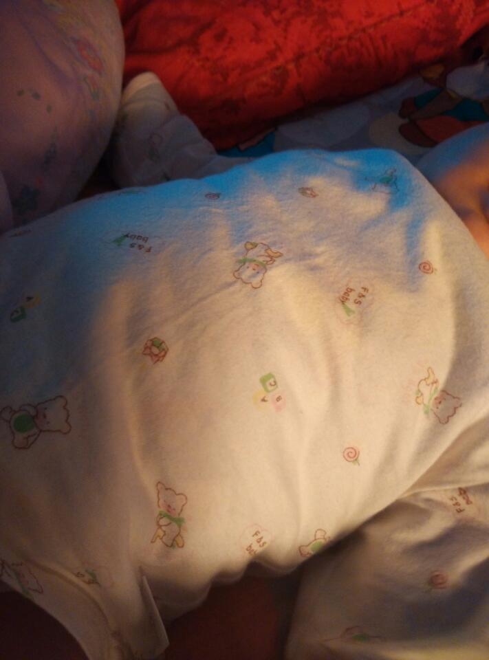 9岁儿童排便有脱肛的现象怎么办,十几岁孩子脱肛