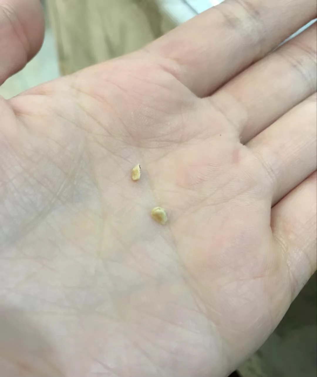 专治牙黄口臭的牙膏推荐测评,牙粉和牙膏刷牙去牙结石哪个好