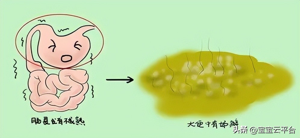 宝宝大便有奶瓣是什么原因造成的,宝宝大便总是有奶瓣是怎么回事
