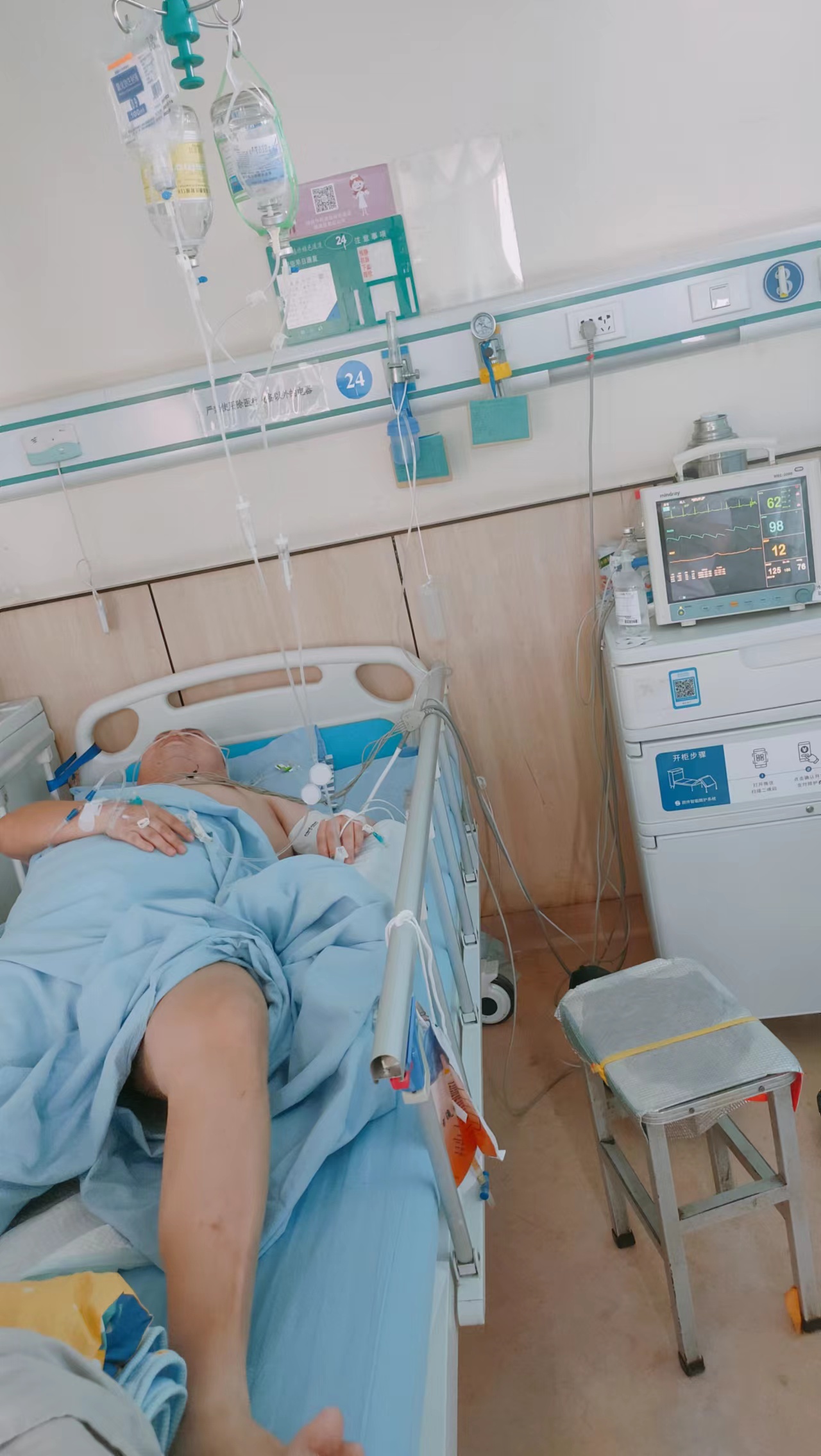 80后中年脑出血,80后脑出血患者