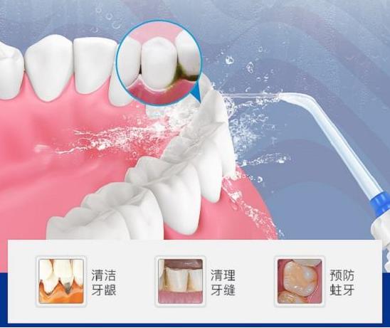 水牙线冲牙器品牌第一名,水牙线冲牙器品牌哪个好用