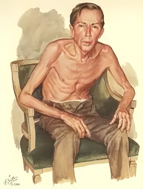 《伤寒论》中这一经方，清胃泻热、健脾和中，改善糖尿病多食易饥