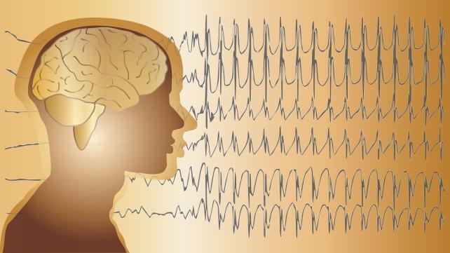 精神分裂症就是人格分裂吗,如何判断一个人有精神分裂症状