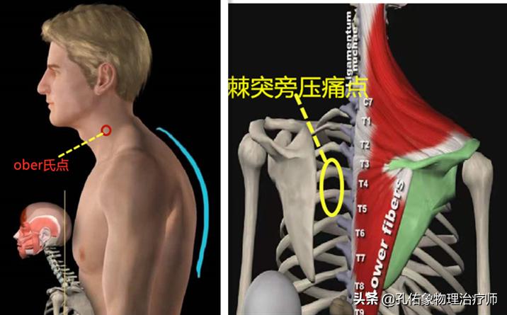 肩膀肌肉紧绷怎么放松,肩膀僵硬不放松怎么办