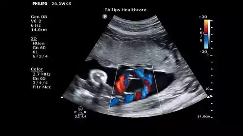 飞利浦philipscvr708,飞利浦philipsspt6627测评