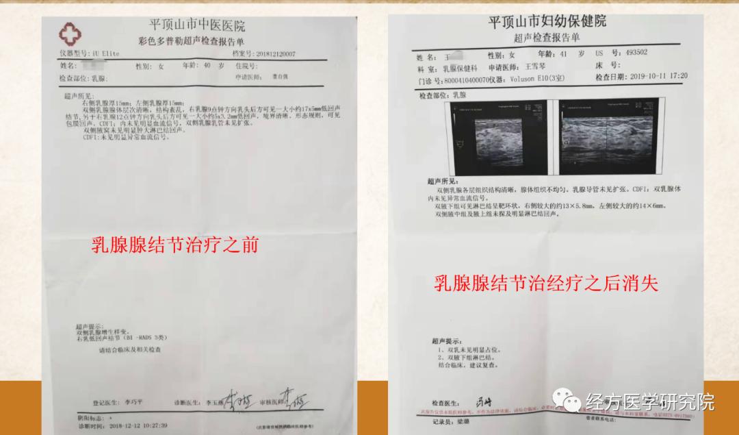 甲状腺结节乳腺增生经方案例,王付教授谈结节