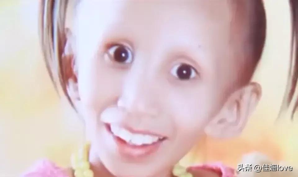 14岁女孩拥有80多岁的容貌，生命的尽头是希望妈妈生个弟弟
