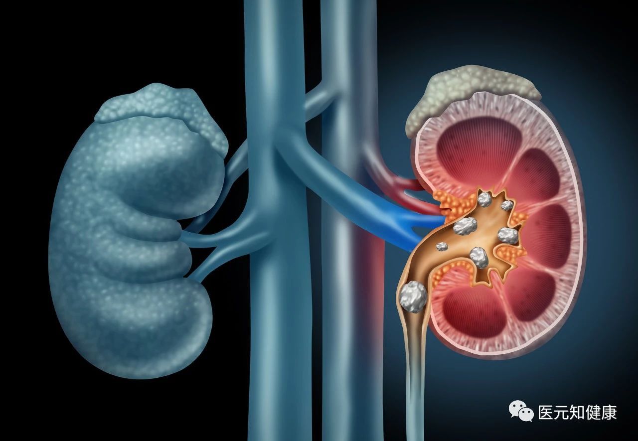 小便像黄豆油黄是怎么回事,小便发黄还有黄渣怎么回事