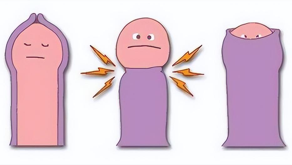 关于阴茎癌你知道多少？阴茎癌都要“一刀切”吗？建议男性们看看