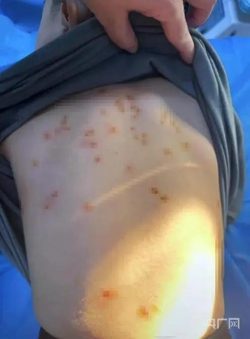 泡温泉后感染了hpv,泡温泉感染HPV是什么意思