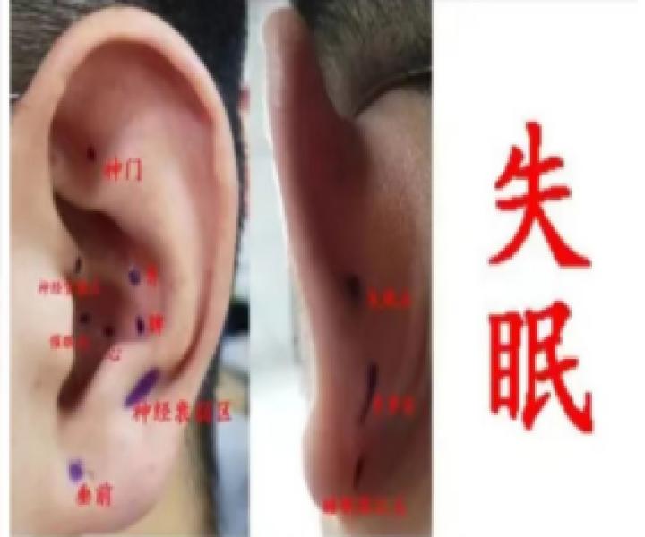 曲靖市二院健康义诊,曲靖中医义诊