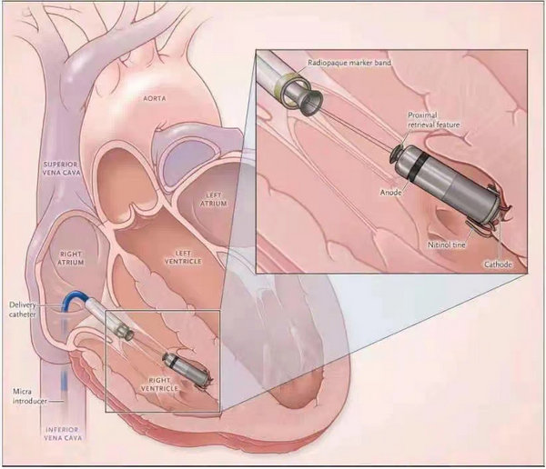 绵阳市第四人民医院在哪里,绵阳第四人民医院地址