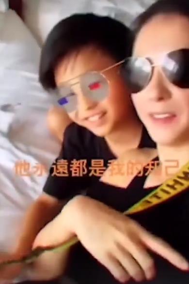 张柏芝手臂伤疤被曝照片,张柏芝被自家宠物狗咬伤视频