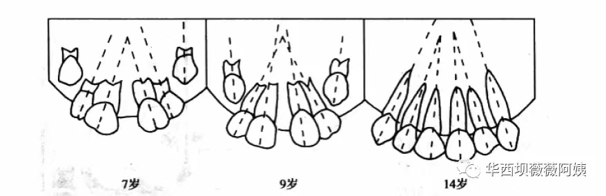 儿童早期牙齿矫正华西,华西口腔小孩矫正牙齿是什么科