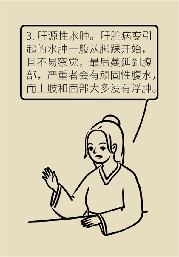 身体出现水肿需要做哪些检查,身体出现水肿吃什么药好