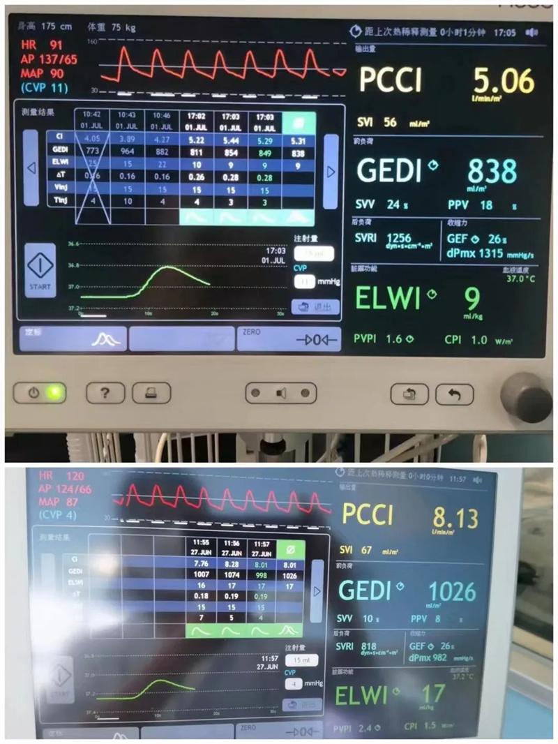 男子全身着火被灭火后续,发生火灾吸入浓烟多久昏迷