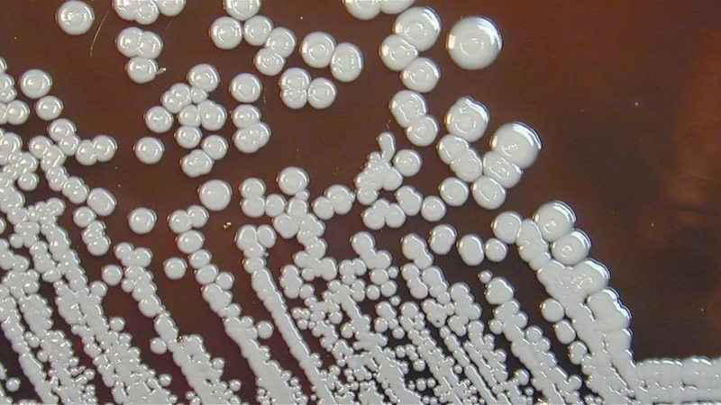 美国土壤和水中惊现类鼻疽病原菌，致死率50%！可怕，人普遍易感