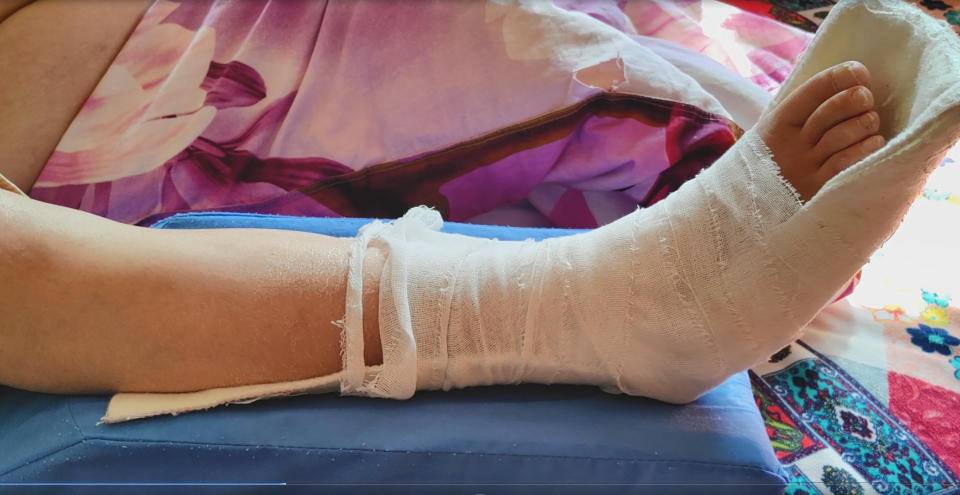 商场上班员工在商场摔骨折了,顾客在店里摔骨折了怎么报警