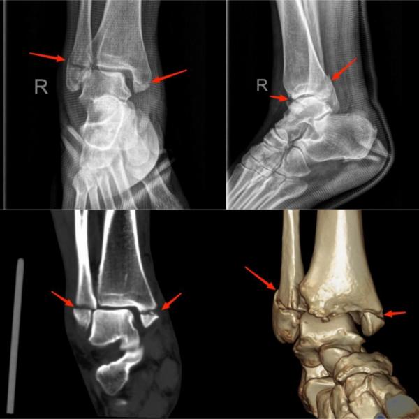 健康小知识运动损伤的常见症状,运动损伤知识科普宣传内容