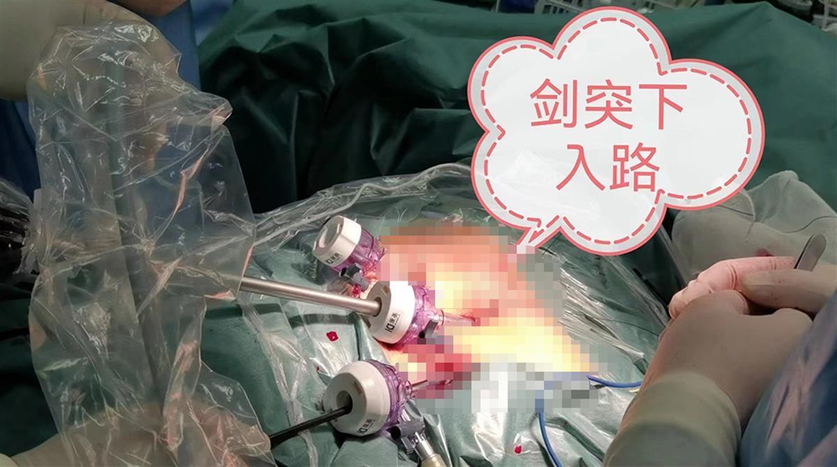 高龄老人患胸腺瘤发展慢,老年人胸口疼痛特效药