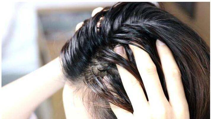 夏天头发容易出油怎么办,夏天头发容易出油要用什么洗发水