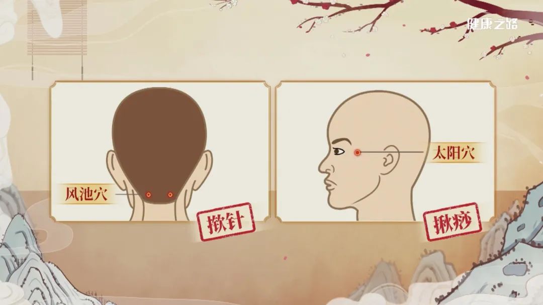 缓解感冒引起的头疼穴位,眼睛酸涩疲劳按什么穴位