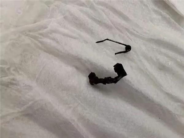 9岁女童私密处分泌异物长达7年，烟台业达医院找到元凶